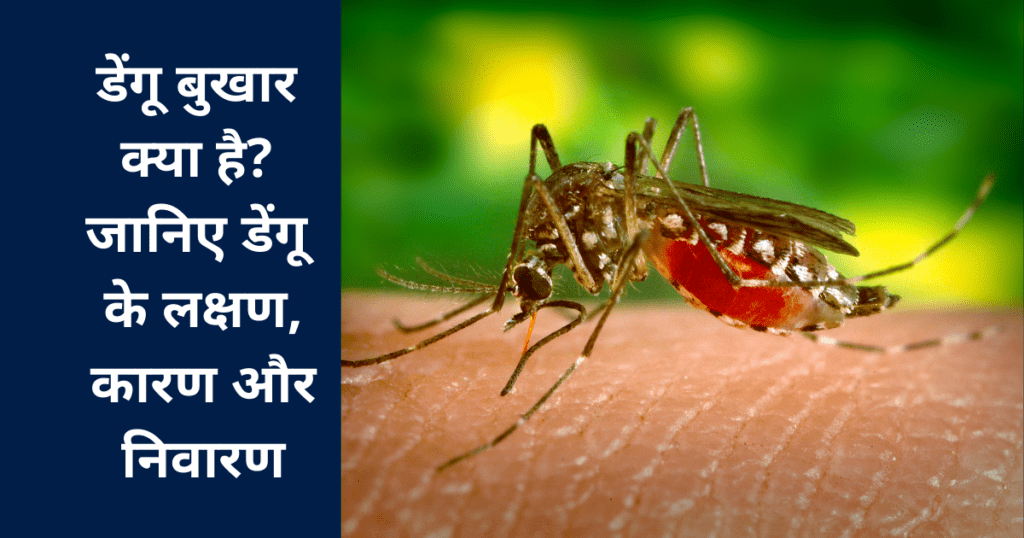 Dengue bukhaar kya hai Janiye Dengue ke lakshan,kaaran aur nivaaran डेंगू बुखार क्या है जानिए डेंगू के लक्षण,कारण और निवारण